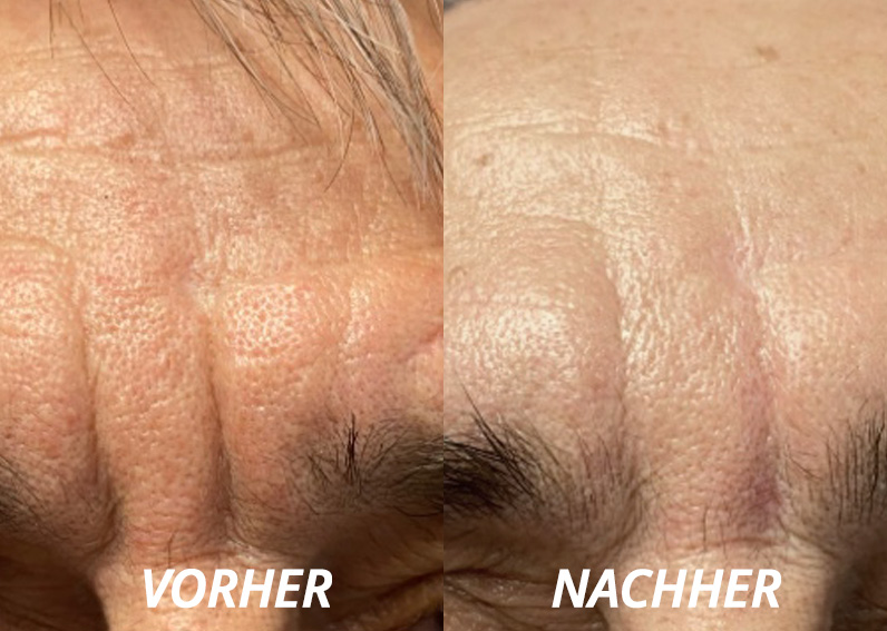Testergebnis Testergebnis