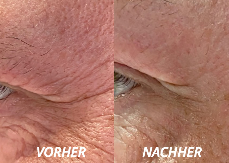 Testergebnis Testergebnis
